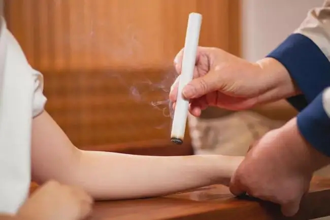 艾灸和拔罐的注意事項！
